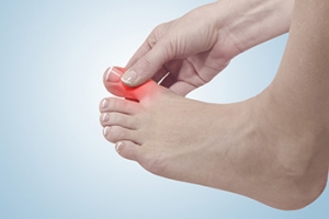 Gout and Coffee